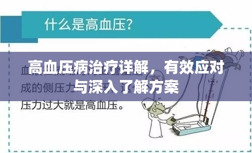 高血压病治疗详解，有效应对与深入了解方案