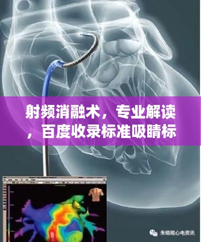 射频消融术，专业解读，百度收录标准吸睛标题！